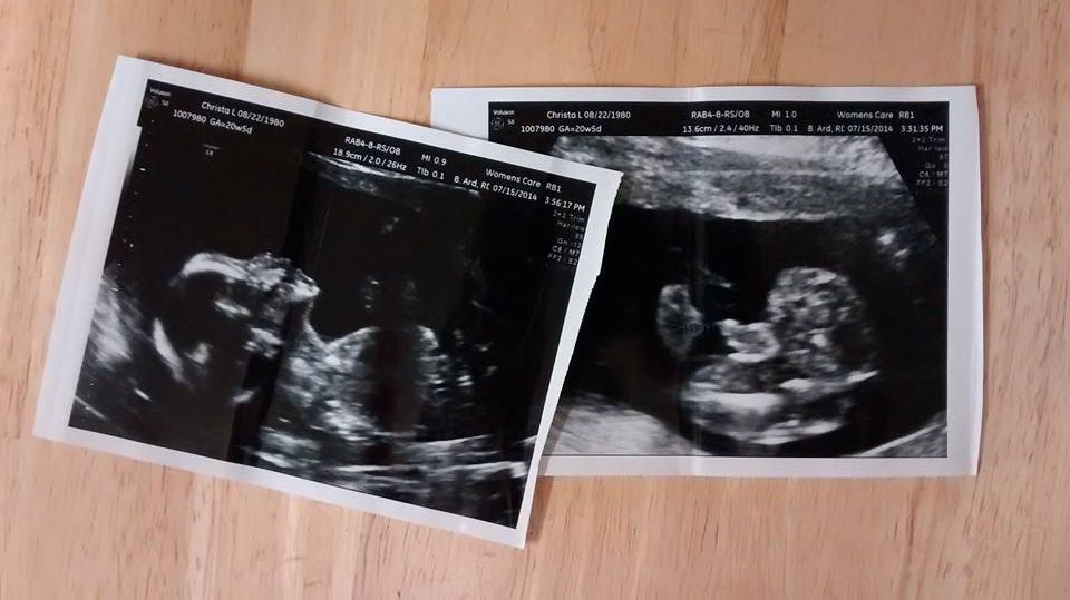 ultrasound photos for the baby boy we are adopting this month